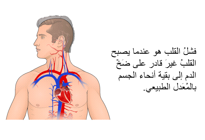 فشلُ القلب هو عندما يصبح القلبُ غيرَ قادر على ضَخِّ الدم إلى بقية أنحاء الجسم بالمُعَدل الطبيعي.