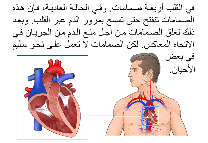 في القلب أربعة صمامات. وفي الحالة العادية، فإن هذه الصمامات تنفتح حتى تسمح بمرور الدم عبر القلب. وبعد ذلك تغلق الصمامات من أجل منع الدم من الجريان في الاتجاه المعاكس. لكن الصمامات لا تعمل على نحو سليم في بعض الأحيان.