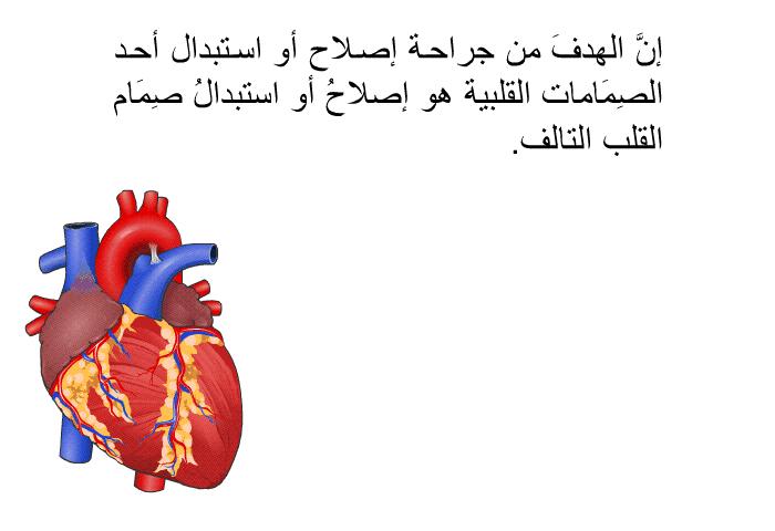 إنَّ الهدفَ من جراحة إصلاح أو استبدال أحد الصِمَامات القلبية هو إصلاحُ أو استبدالُ صِمَام القلب التالف.