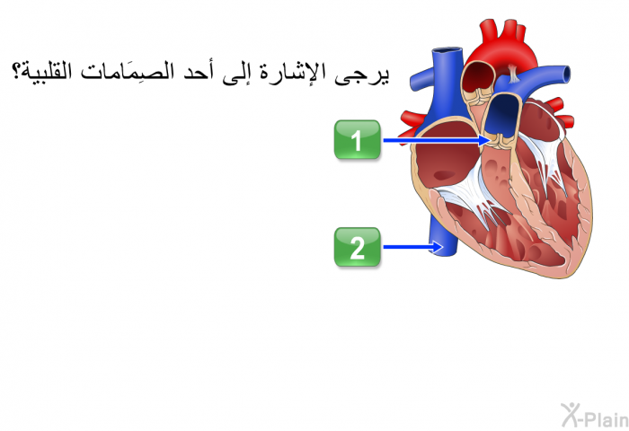 يرجى الإشارة إلى أحد الصِمَامات القلبية؟