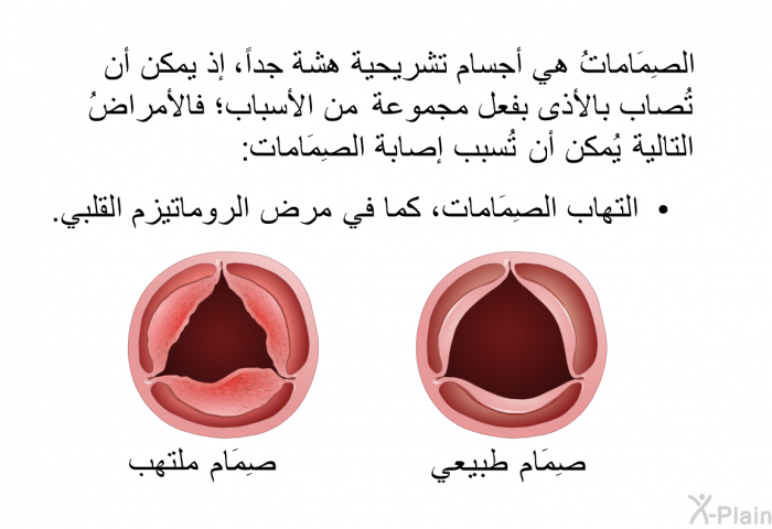 الصِمَاماتُ هي أجسام تشريحية هشة جداً، إذ يمكن أن تُصاب بالأذى بفعل مجموعة من الأسباب؛ فالأمراضُ التالية يُمكن أن تُسبب إصابة الصِمَامات:  التهاب الصِمَامات، كما في مرض الروماتيزم القلبي.