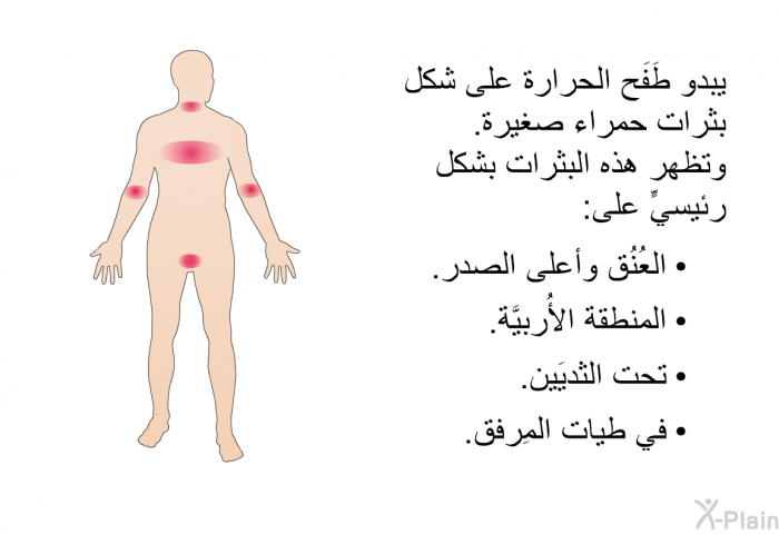 يبدو طَفَح الحرارة على شكل بثرات حمراء صغيرة. وتظهر هذه البثرات بشكل رئيسيٍّ على:   العُنُق وأعلى الصدر.  المنطقة الأُربيَّة.  تحت الثديَين. في طيات المِرفق.