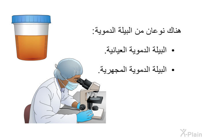 هناك نوعان من البيلة الدموية:  البيلة الدموية العيانية. البيلة الدموية المجهرية.