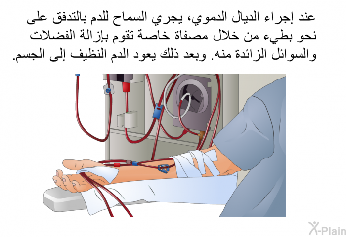 عند إجراء الديال الدموي، يجري السماح للدم بالتدفق على نحو بطيء من خلال مصفاة خاصة تقوم بإزالة الفضلات والسوائل الزائدة منه. وبعد ذلك يعود الدم النظيف إلى الجسم.