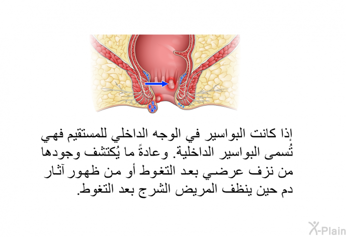 إذا كانت البواسير في الوجه الداخلي للمستقيم فهي تُسمى البواسير الداخلية. وعادةً ما يُكتشف وجودها من نزف عرضي بعد التغوط أو من ظهور آثار دم حين ينظف المريض الشرج بعد التغوط.