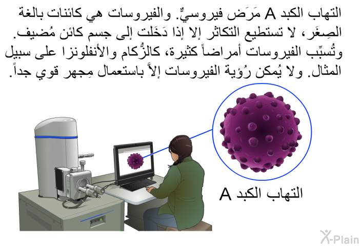 التهاب الكبد A مَرَض فيروسيٌّ. والفيروسات هي كائنات بالغة الصِغَر، لا تستطيع التكاثر إلا إذا دَخَلت إلى جسم كائن مُضيف. وتُسبِّب الفيروسات أمراضاً كثيرة، كالزُّكام والأنفلونزا على سبيل المثال. ولا يُمكن رُؤية الفيروسات إلاَّ باستعمال مِجهر قوي جدَّاً.