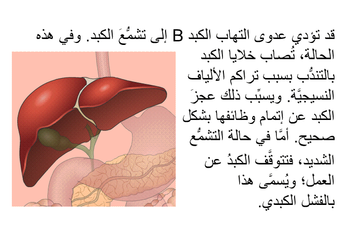 قد تؤدي عدوى التهاب الكبد B إلى تشمُّعَ الكبد. وفي هذه الحالة، تُصاب خلايا الكبد بالتندُّب بسبب تراكم الألياف النسيجيَّة. ويسبِّب ذلك عجزَ الكبد عن إتمام وظائفها بشكل صحيح. أمَّا في حالة التشمُّع الشديد، فتتوقَّف الكبدُ عن العمل؛ ويُسمَّى هذا بالفشل الكبدي.