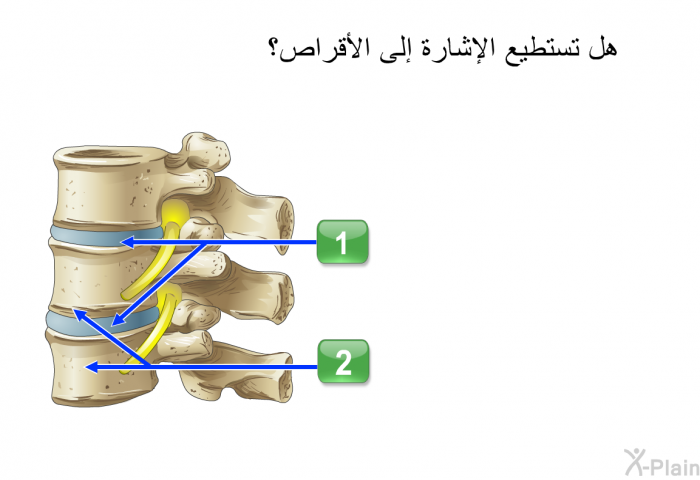 هل تستطيع الإشارة إلى الأقراص.