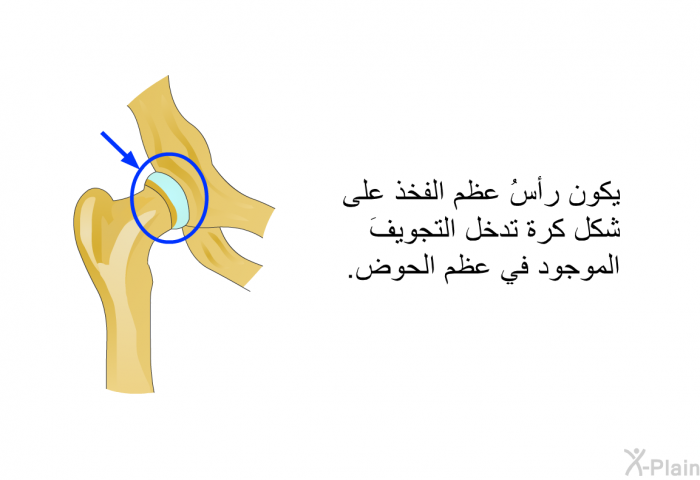 يكون رأسُ عظم الفخذ على شكل كرة تدخل التجويفَ الموجود في عظم الحوض.