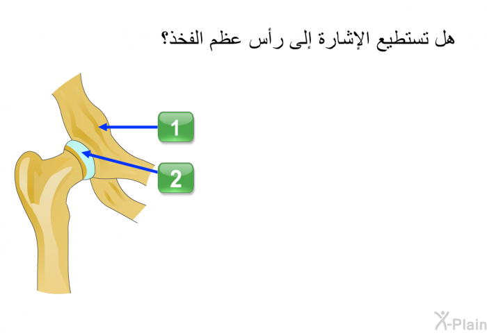 هل تستطيع الإشارة إلى رأس عظم الفخذ؟