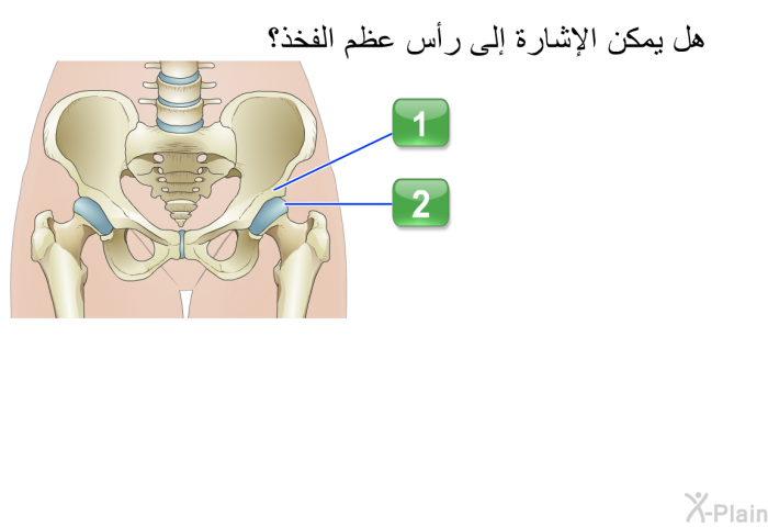 هل يمكن الإشارة إلى رأس عظم الفخذ؟