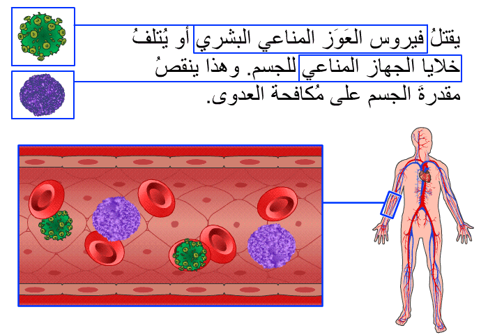 يقتلُ فيروس العَوَز المناعي البشري أو يُتلفُ خلايا الجهاز المناعي للجسم. وهذا ينقصُ مقدرةَ الجسم على مُكافحة العدوى.