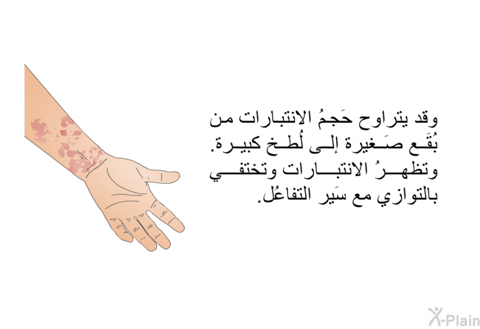 وقد يتراوح حَجمُ الانتبارات من بُقَع صَغيرة إلى لُطخ كبيرة. وتظهرُ الانتبارات وتختفي بالتوازي مع سَير التفاعُل.