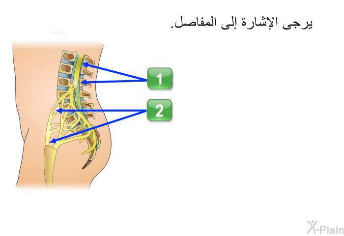 يرجى الإشارة إلى المفاصل.