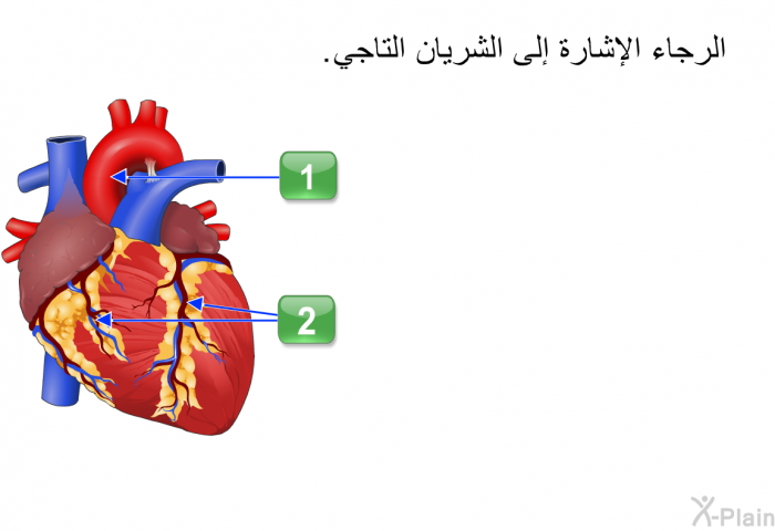 الرجاء الإشارة إلى الشريان التاجي.