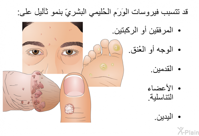 قد تتسبب فيروسات الوَرَم الحُليمي البشريّ بنمو ثآليل على:   المرفقين أو الركبتين.  الوجه أو العُنق.  القدمين.  الأعضاء التناسلية. اليدين.