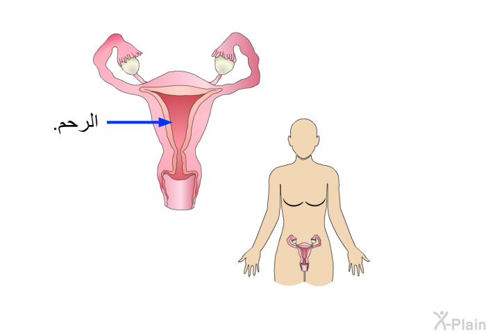 الرحم.