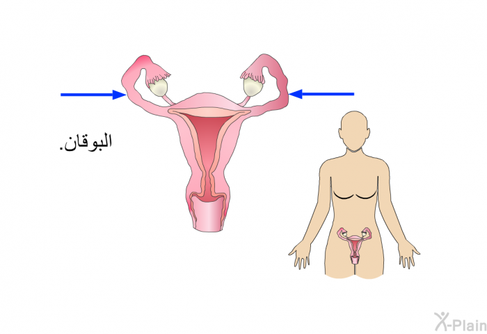 البوقان.