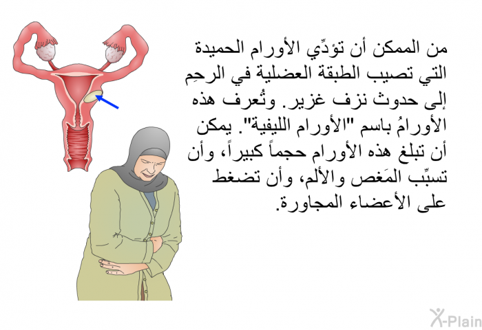 من الممكن أن تؤدِّي الأورام الحميدة التي تصيب الطبقة العضلية في الرحِم إلى حدوث نزف غزير. وتُعرف هذه الأورامُ باسم "الأورام الليفية". يمكن أن تبلغ هذه الأورام حجماً كبيراً، وأن تسبِّب المَغص والألم، وأن تضغط على الأعضاء المجاورة.