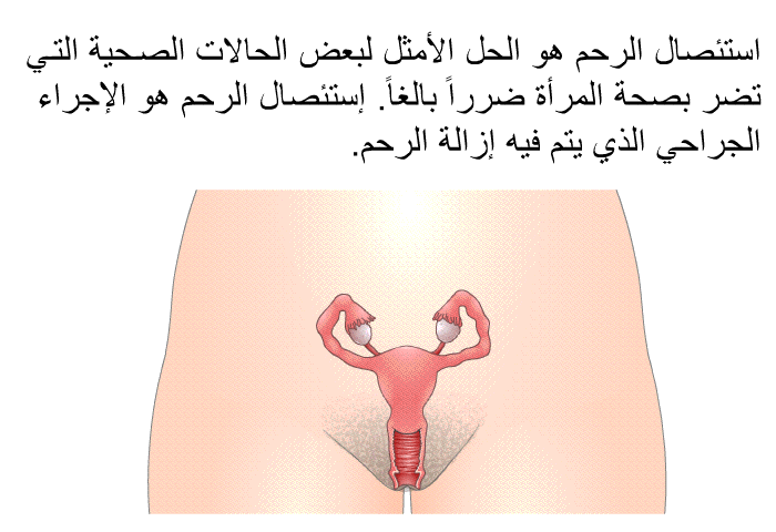 استئصال الرحم هو الحل الأمثل لبعض الحالات الصحية التي تضر بصحة المرأة ضرراً بالغاً<B>. </B>إستئصال الرحم هو الإجراء الجراحي الذي يتم فيه إزالة الرحم<B>.</B>