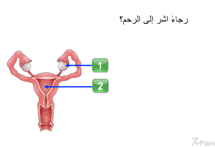 رجاءً اشر إلى الرحم.