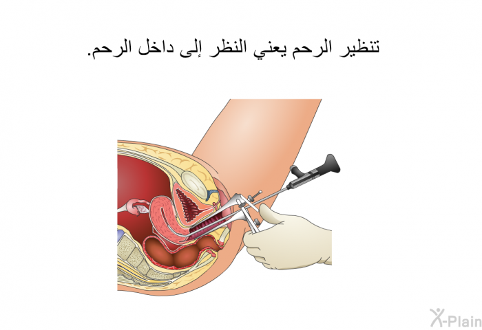 تنظير الرحم يعني النظر إلى داخل الرحم.