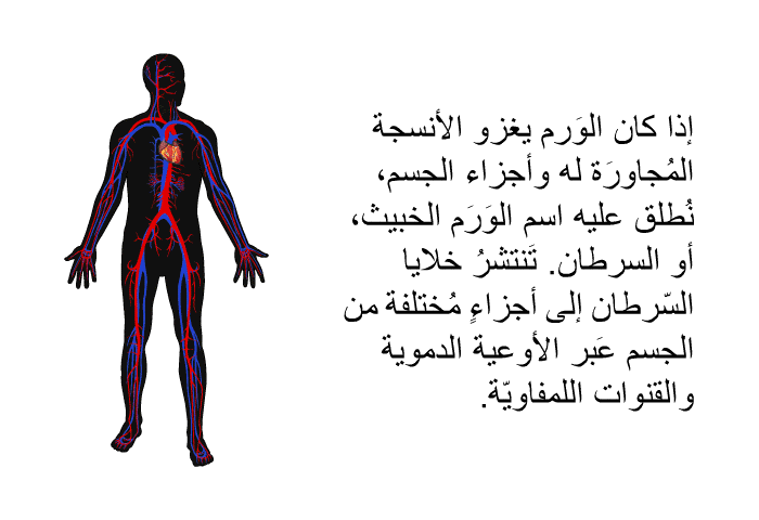 إذا كان الوَرم يغزو الأنسجة المُجاورَة له وأجزاء الجسم، نُطلق عليه اسم الوَرَم الخبيث، أو السرطان. تَنتشرُ خلايا السّرطان إلى أجزاءٍ مُختلفة من الجسم عَبر الأوعية الدموية والقنوات اللمفاويّة.