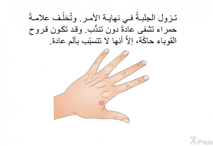 تزول الجلبةُ في نهاية الأمر. وتُخلّف علامةً حمراء تشفى عادةً دون تندُّب. وقد تكون قروح القَوباء حاكّة، إلاَّ أنها لا تتسبّب بألم عادة.