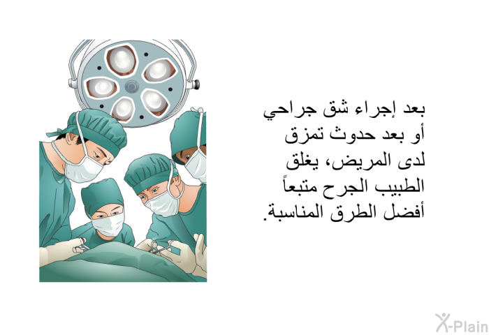 بعد إجراء شق جراحي أو بعد حدوث تمزق لدى المريض، يغلق الطبيب الجرح متبعاً أفضل الطرق المناسبة.