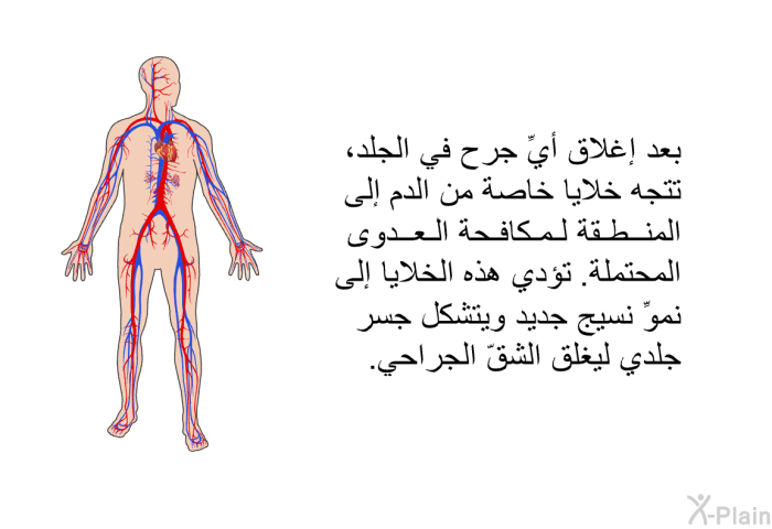 بعد إغلاق أيِّ جرح في الجلد، تتجه خلايا خاصة من الدم إلى المنطقة لمكافحة العدوى المحتملة. تؤدي هذه الخلايا إلى نموِّ نسيج جديد ويتشكل جسر جلدي ليغلق الشقّ الجراحي.