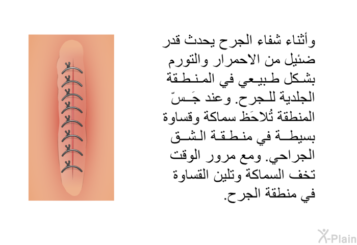 وأثناء شفاء الجرح يحدث قدر ضئيل من الاحمرار والتورم بشكل طبيعي في المنطقة الجلدية للجرح. وعند جَسّ المنطقة تُلاحَظ سماكة وقساوة بسيطة في منطقة الشق الجراحي. ومع مرور الوقت تخف السماكة وتلين القساوة في منطقة الجرح.