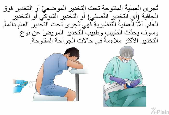 تُجرى العمليةُ المفتوحة تحت التخدير الموضعيِّ أو التخدير فوق الجافية (أي التخدير النِّصفي) أو التَّخدير الشَّوكي أو التخدير العام. أمَّا العمليةُ التنظيرية فهي تُجرى تحت التخدير العام دائماً. وسوف يحدِّث الطبيب وطبيب التخدير المريضَ عن نوع التخدير الأكثر ملاءمةً في حالات الجراحة المفتوحة.