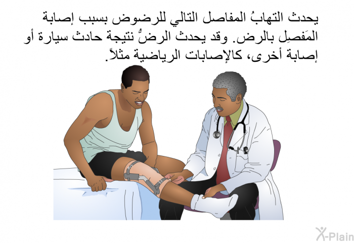 يحدث التهابُ المفاصل التالي للرضوض بسبب إصابة المَفصِل بالرض. وقد يحدث الرضُّ نتيجة حادث سيارة أو إصابة أخرى، كالإصابات الرياضية مثلاً.
