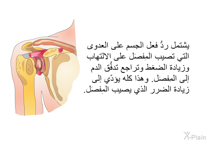 يشتمل ردُّ فعل الجسم على العدوى التي تصيب المَفصِل على الالتهاب وزيادة الضغط وتراجع تدفُّق الدم إلى المَفصِل. وهذا كله يؤدِّي إلى زيادة الضرر الذي يصيب المَفصِل.