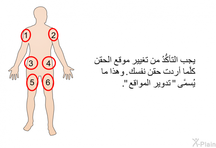 يجب التأكُّدُ من تغيير موقع الحقن كلَّما أردت حقن نفسك. وهذا ما يُسمَّى "تدوير المواقع".