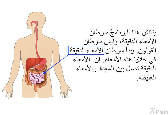 يناقش هذا البرنامجُ سرطانَ الأمعاء الدقيقة، وليس سرطان القولون. يبدأ سرطان الأمعاء الدقيقة في خلايا هذه الأمعاء. إن الأمعاء الدقيقة تصل بين المَعِدة والأمعاء الغليظة.