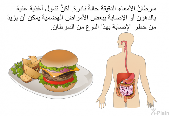 سرطانُ الأمعاء الدقيقة حالةٌ نادرة. لكنَّ تناول أغذية غنية بالدهون أو الإصابة ببعض الأمراض الهضمية يمكن أن يزيدَ من خطر الإصابة بهذا النوع من السرطان.