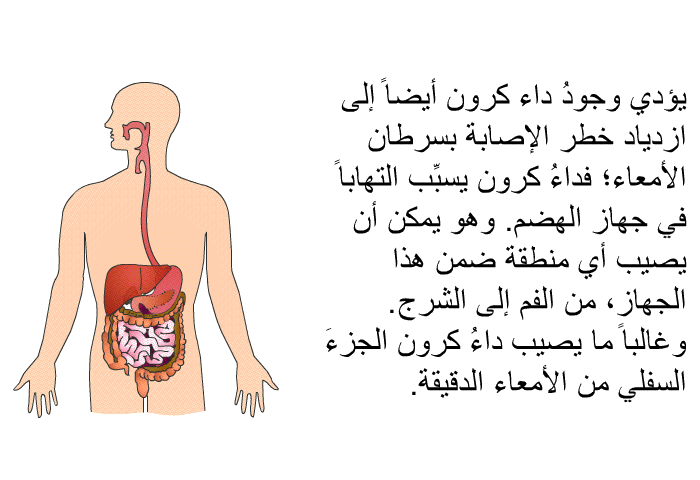 يؤدي وجودُ داء كرون أيضاً إلى ازدياد خطر الإصابة بسرطان الأمعاء؛ فداءُ كرون يسبِّب التهاباً في جهاز الهضم. وهو يمكن أن يصيب أي منطقة ضمن هذا الجهاز، من الفم إلى الشرج. وغالباً ما يصيب داءُ كرون الجزءَ السفلي من الأمعاء الدقيقة.