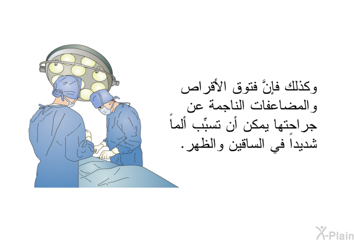 وكذلك فإنَّ فتوق الأقراص والمضاعفات الناجمة عن جراحتها يمكن أن تسبِّب ألماً شديداً في الساقين والظهر.