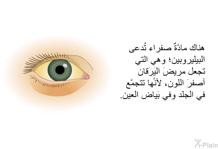 هناك مادَّةٌ صفراء تُدعى البيليروبين؛ وهي التي تجعل مريضَ اليَرَقان أصفرَ اللون، لأنَّها تتجمَّع في الجلد وفي بَياض العين.