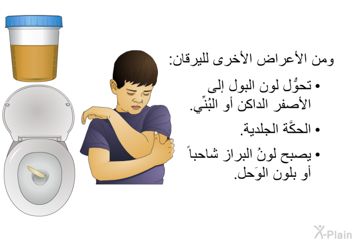 ومن الأعراض الأخرى لليرقان:   تحوُّل لون البول إلى الأصفر الداكن أو البُنِّي.  الحكَّة الجلدية. يصبح لونُ البراز شاحباً أو بلون الوَحل.