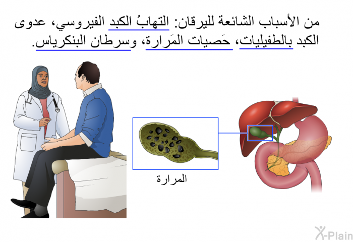 من الأسباب الشائعة لليرقان: التهابُ الكبد الفيروسي، عدوى الكبد بالطفيليات، حَصيات المَرارة، وسرطان البنكرياس.
