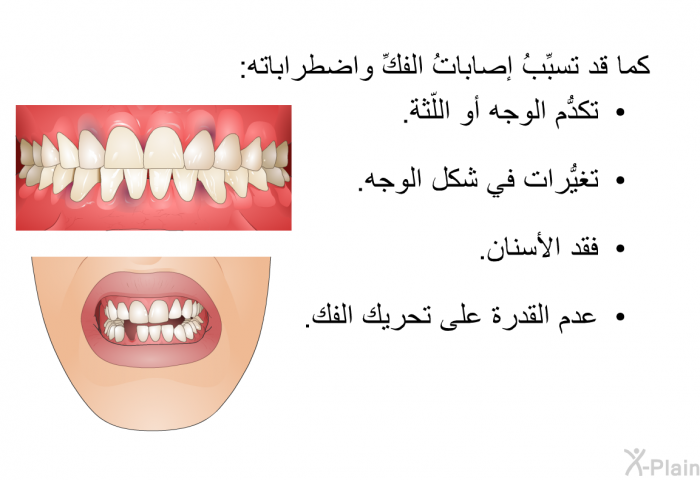 كما قد تسبِّبُ إصاباتُ الفكِّ واضطراباته:  تكدُّم الوجه أو اللّثة. تغيُّرات في شكل الوجه. فقد الأسنان. عدم القدرة على تحريك الفك.