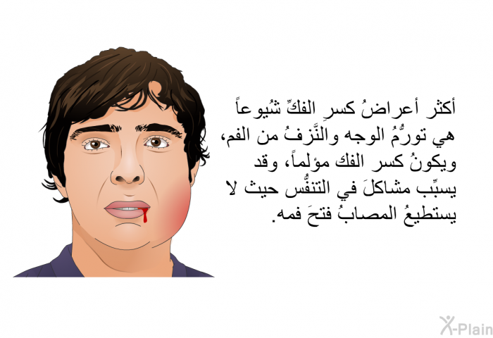 أكثر أعراض كسرِ الفكِّ شُيوعاً هي تورُّمُ الوجه والنَّزفُ من الفم ، ويكونُ كسر الفك مؤلماً، وقد يسبِّب مشاكلَ في التنفُّس حيث لا يستطيعُ المصابُ فتحَ فمه.