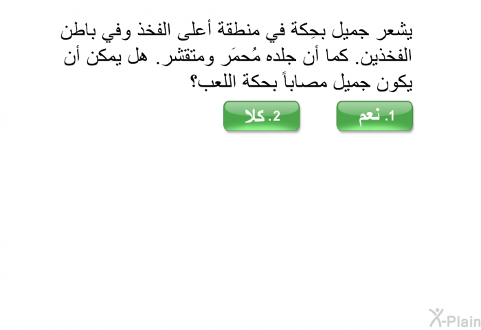 يشعر جميل بحِكة في منطقة أعلى الفخذ وفي باطن الفخذين. كما أن جلده مُحمَر ومتقشر. هل يمكن أن يكون جميل مصاباً بحكة اللعب؟