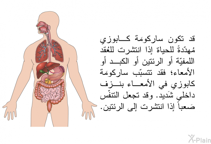 قد تكون ساركومَة كابوزي مُهدّدةً للحياة إذا انتشرت للعُقد اللمفيّة أو الرئتين أو الكبد أو الأمعاء؛ فقد تتسبّب ساركومَة كابوزي في الأمعاء بنزف داخلي شَديد. وقد تجعل التنفّس صَعباً إذا انتشرت إلى الرئتين.