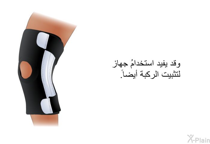 وقد يفيد استخدامُ جهاز لتثبيت الركبة أيضاً.