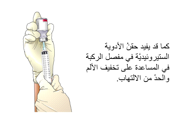 كما قد يفيد حقنُ الأدوية الستيروئيديَّة في مفصل الركبة في المساعدة على تخفيف الألم والحدِّ من الالتهاب.