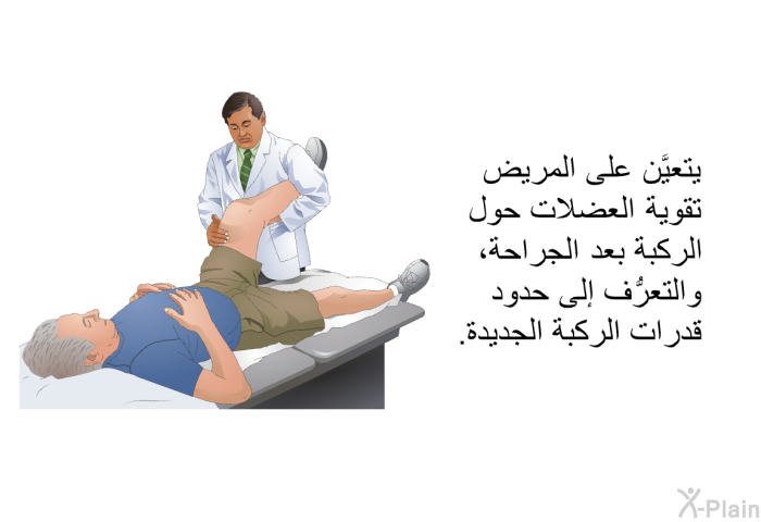 يتعيَّن على المريض تقوية العضلات حول الركبة بعد الجراحة، والتعرُّف إلى حدود قدرات الركبة الجديدة.