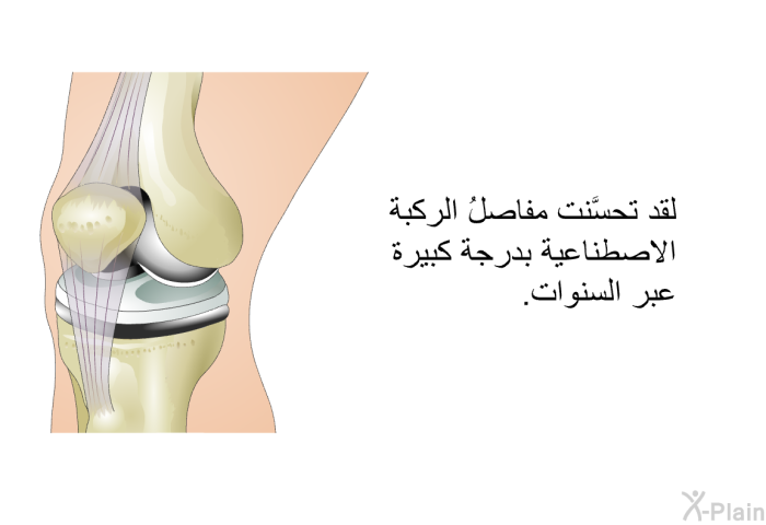 لقد تحسَّنت مفاصلُ الركبة الاصطناعية بدرجة كبيرة عبر السنوات.